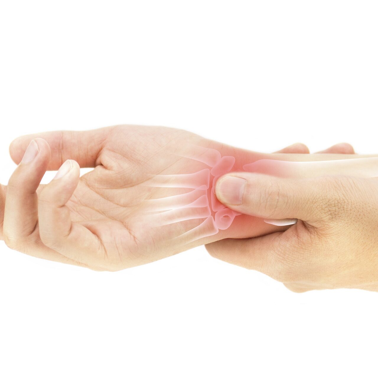 lesione legamentose della mano e del polso