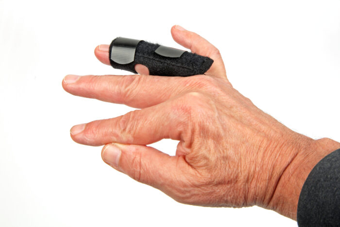 Lesione tendine estensore dito anulare