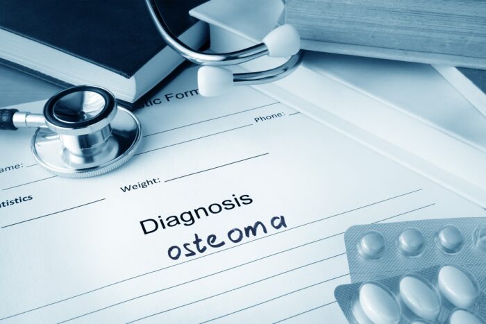 Osteoma